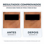 EUCERIN Creme de Olhos Clareador de Olheiras Anti-Pigment 15ml