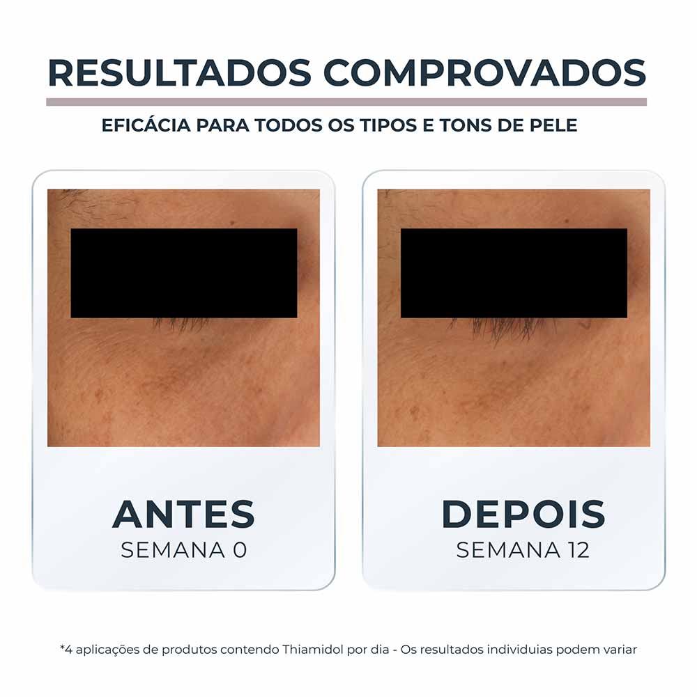 EUCERIN Creme de Olhos Clareador de Olheiras Anti-Pigment 15ml