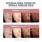 Creme Facial Dia Eucerin Anti-Pigment Dia FPS 30 - 50ml