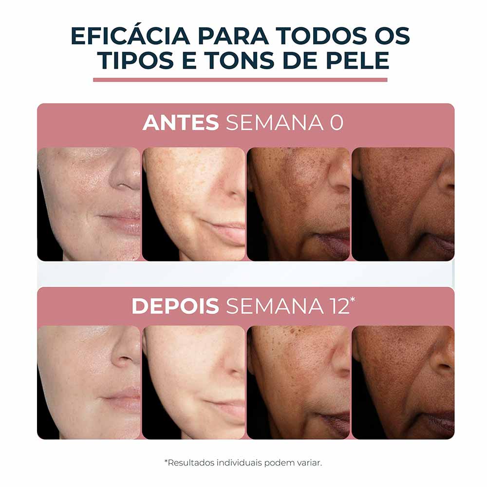 Creme Facial Dia Eucerin Anti-Pigment Dia FPS 30 - 50ml