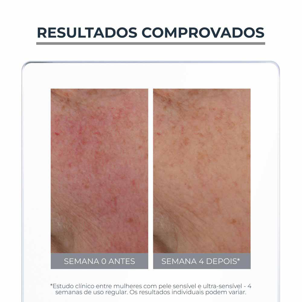 EUCERIN Creme Facial Antivermelhidão Anti-Redness Peles Sensíveis FPS30 50ml