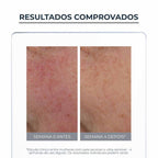 EUCERIN Creme Facial Antivermelhidão Anti-Redness Peles Sensíveis FPS30 50ml